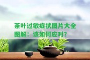 茶葉過(guò)敏癥狀圖片大全圖解：該怎樣應(yīng)對(duì)？