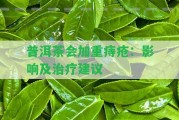 普洱茶會(huì)加重痔瘡：作用及治療建議