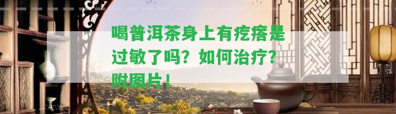 喝普洱茶身上有疙瘩是過敏了嗎？怎樣治療？附圖片！